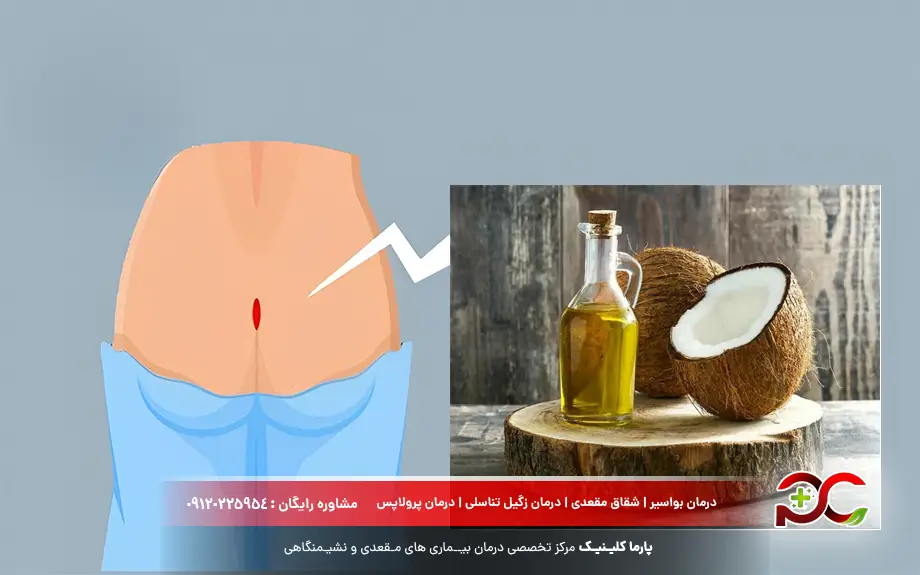 روغن نارگیل و کیست مویی در خانه