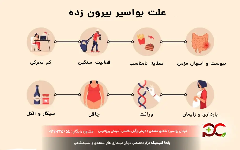علت بواسیر بیرون زده