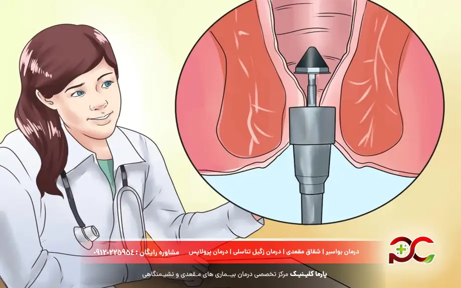 درمان هموروئید ترومبوزه