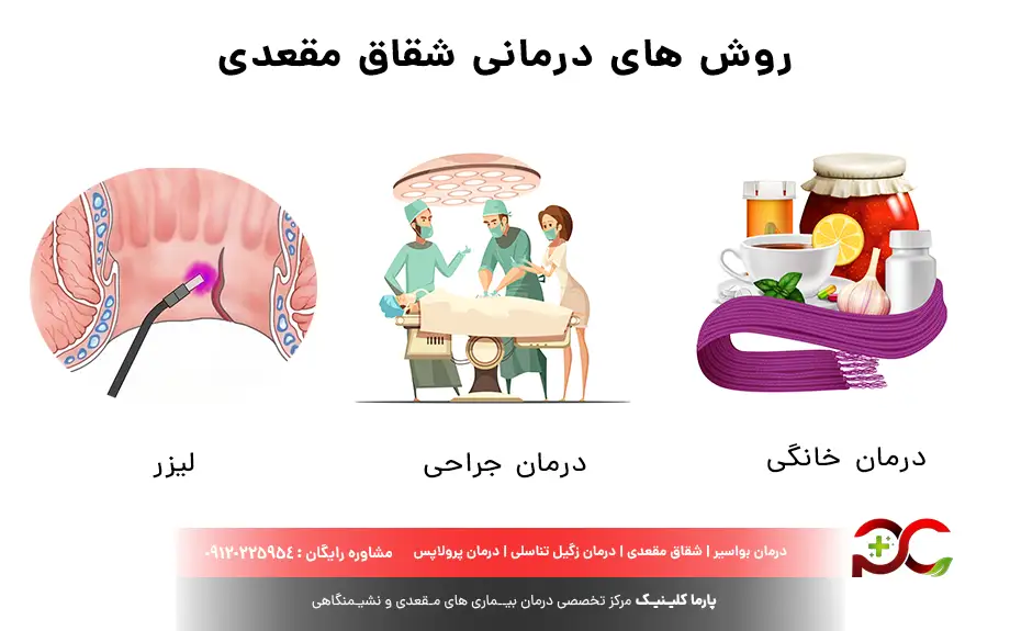 روش های درمانی شقاق مقعدی