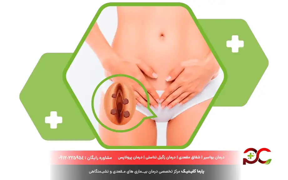 لیزر زگیل تناسلی در بارداری