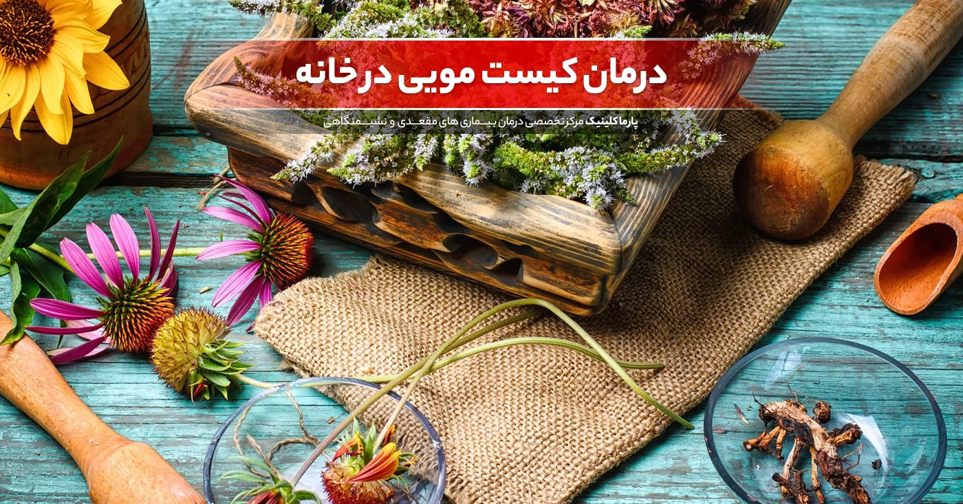 روشهای خانگی برای درمان کیست مویی