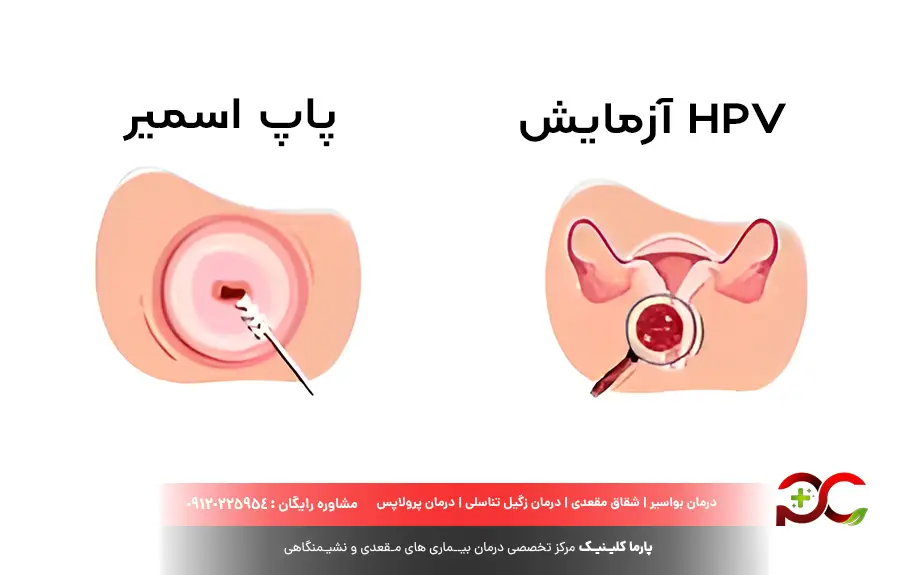 آزمایش HPV