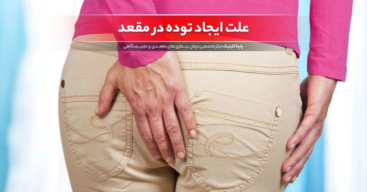 6 علت ایجاد توده در مقعد