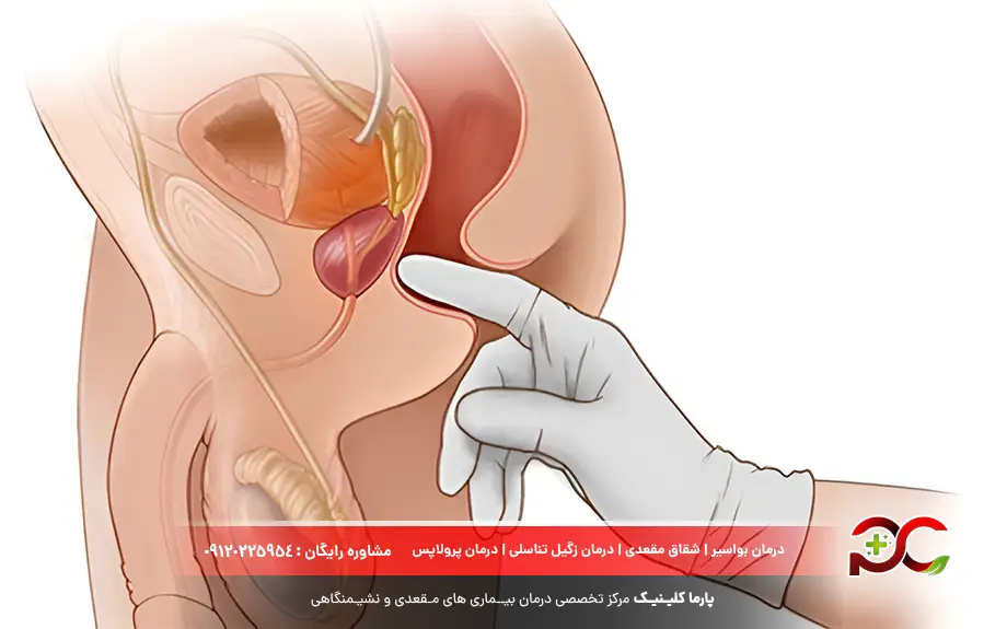 تشخیص هموروئید در کودکان