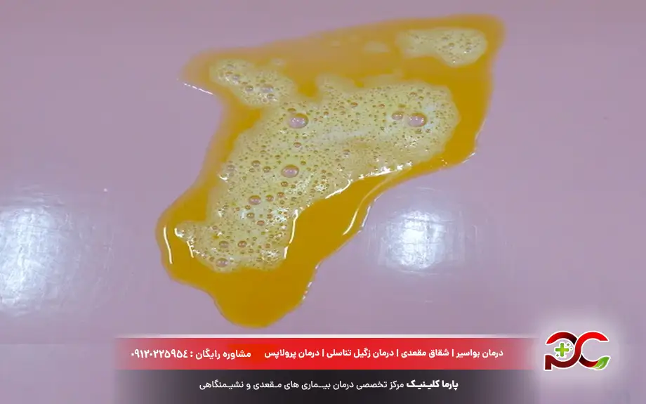 اسهال آبکی زرد رنگ