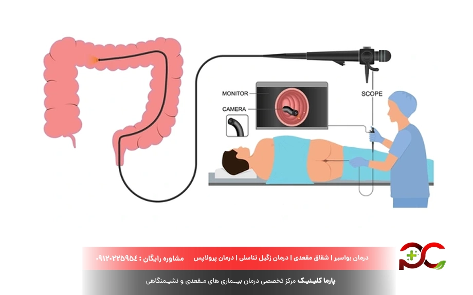 آزمایش کولونوسکوپی چیست؟