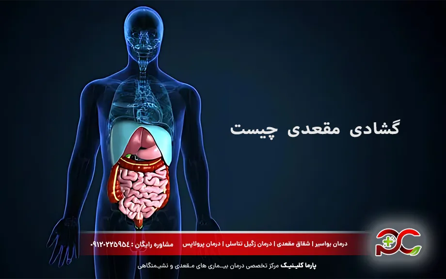 گشادی مقعدی چیست؟