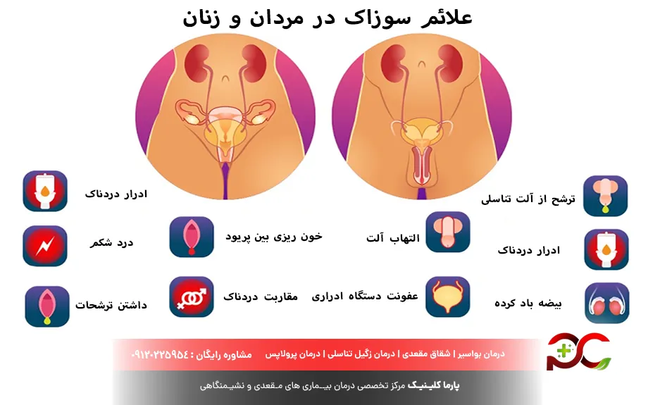 علائم سوزاک
