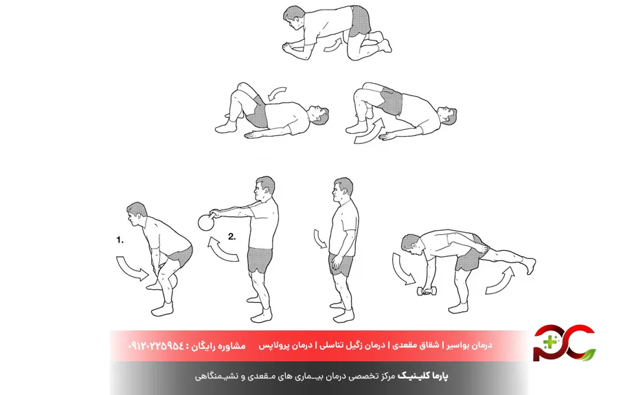 تمرین عضلات لگن بیوفیدبک