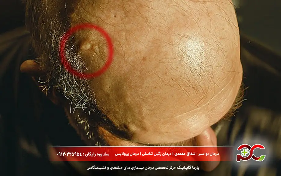 کیست سباسه سر