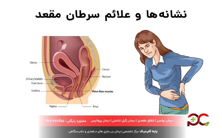نشانهها و علائم سرطان مقعد