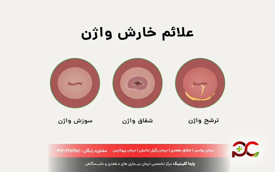 علائم خارش واژن