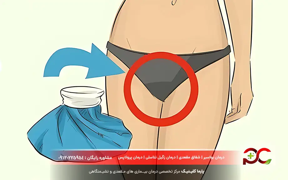 درمان خانگی خارش واژن