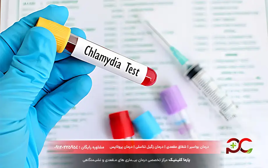 تشخیص و آزمایش کلامیدیا