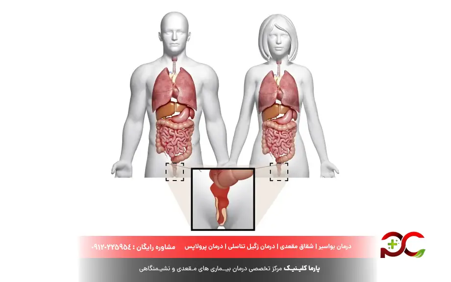 کلامیدیا چیست
