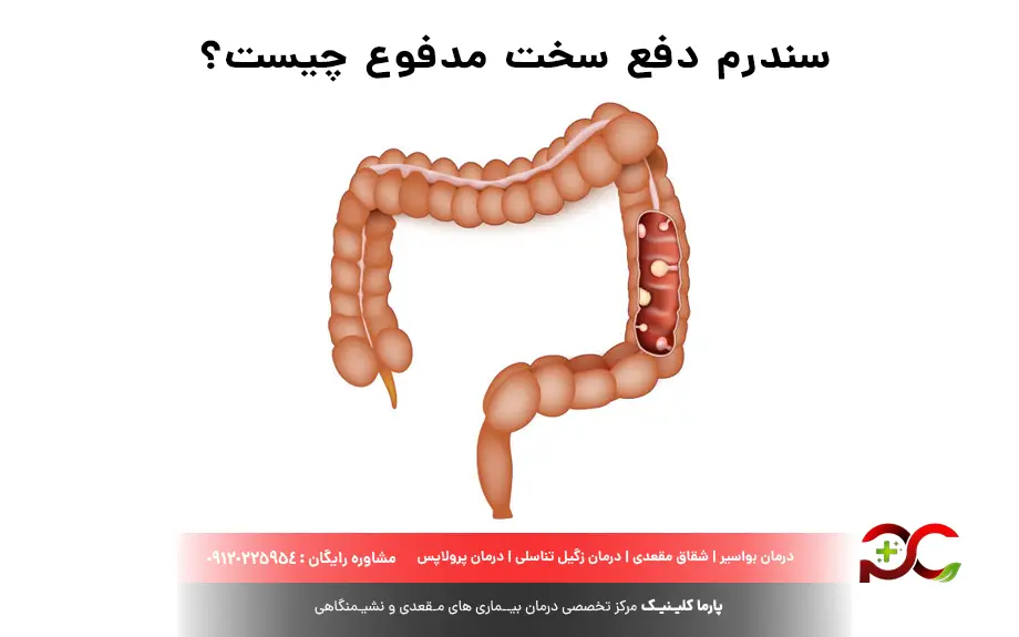 سندرم دفع سخت مدفوع چیست؟