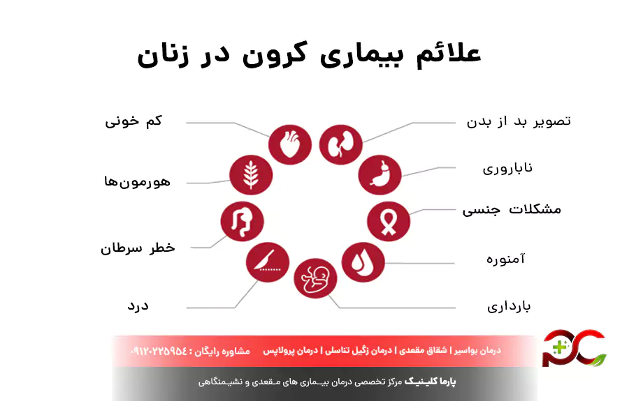 علائم بیماری کرون در زنان