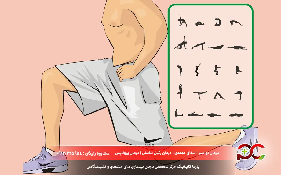 ورزش کگل چیست؟