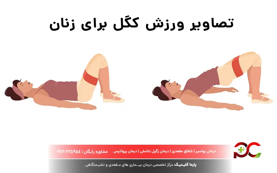 تصاویر ورزش کگل برای زنان