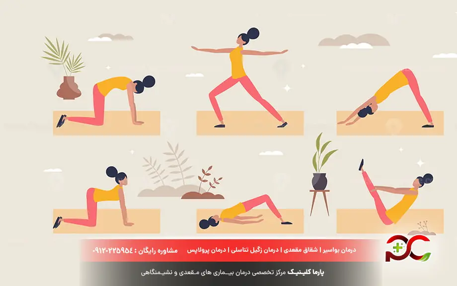 ورزش کگل برای بهبود افتادگی رحم