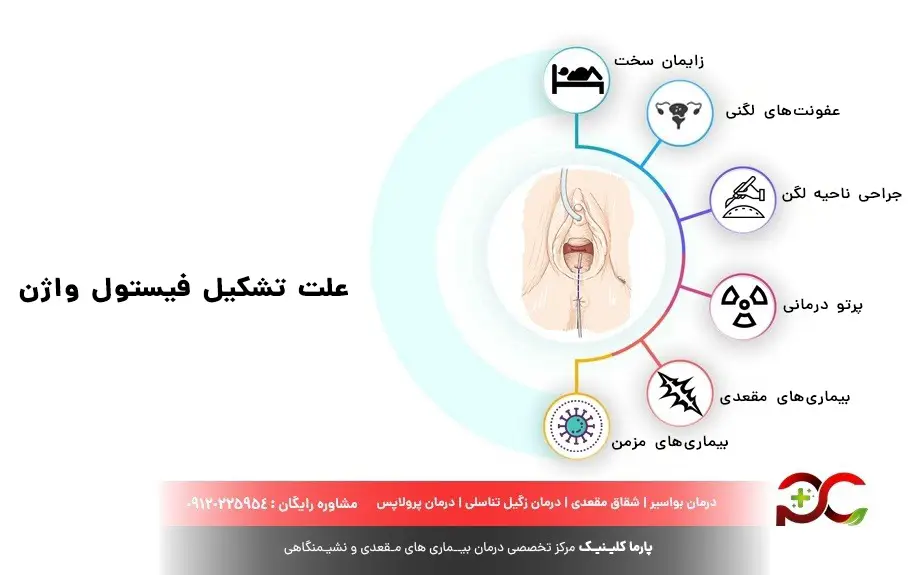علت تشکیل فیستول واژن
