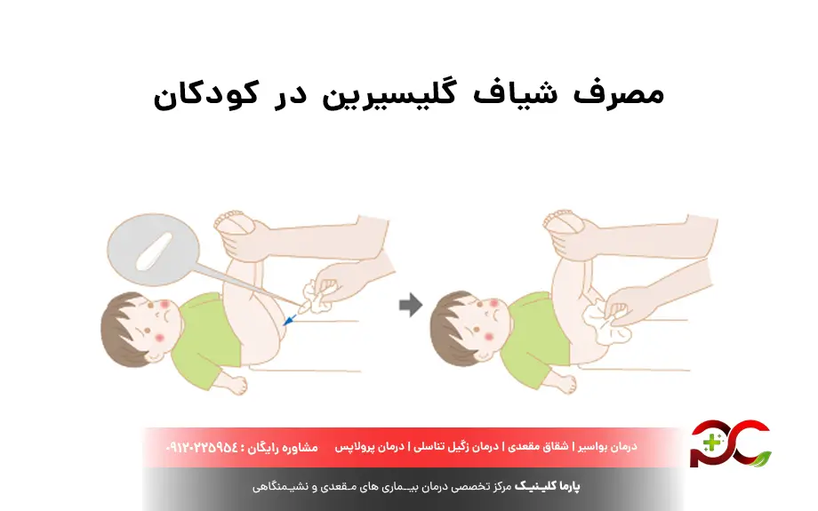 شیاف گلیسیرین بعد از چند دقیقه اثر میکند