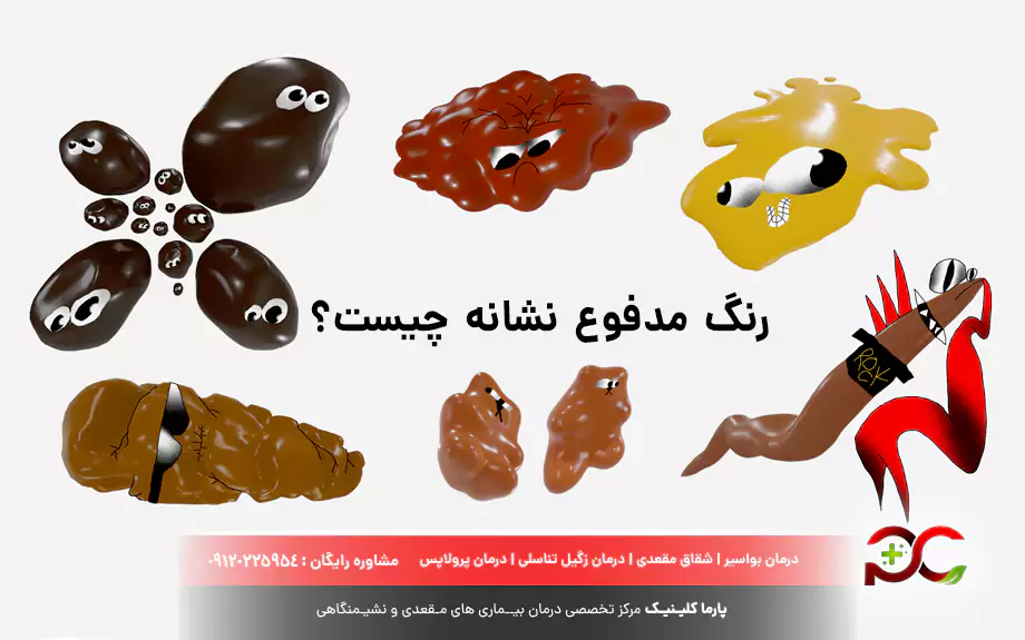 رنگ مدفوع نشانه چیست؟