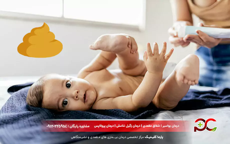 رنگ مدفوع نوزاد