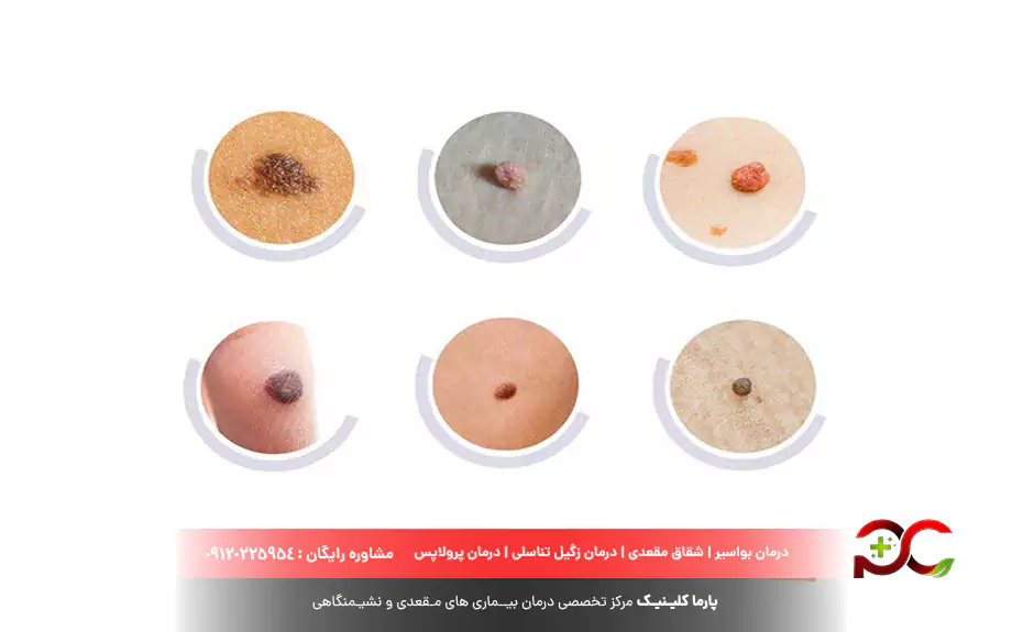 علت بوجود آمدن اسکین تگ