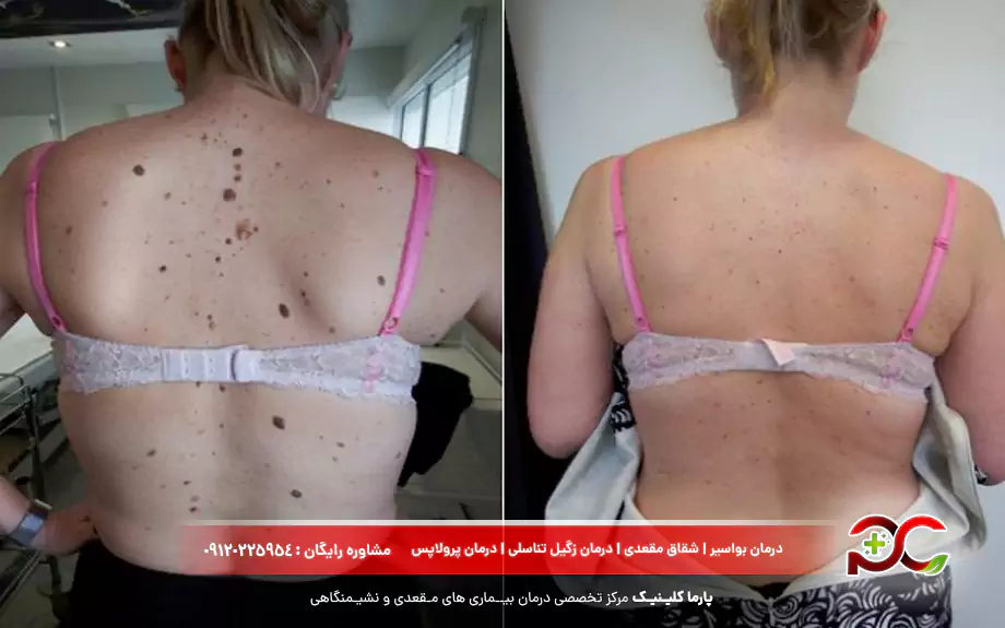 عکس اسکین تگ در زنان