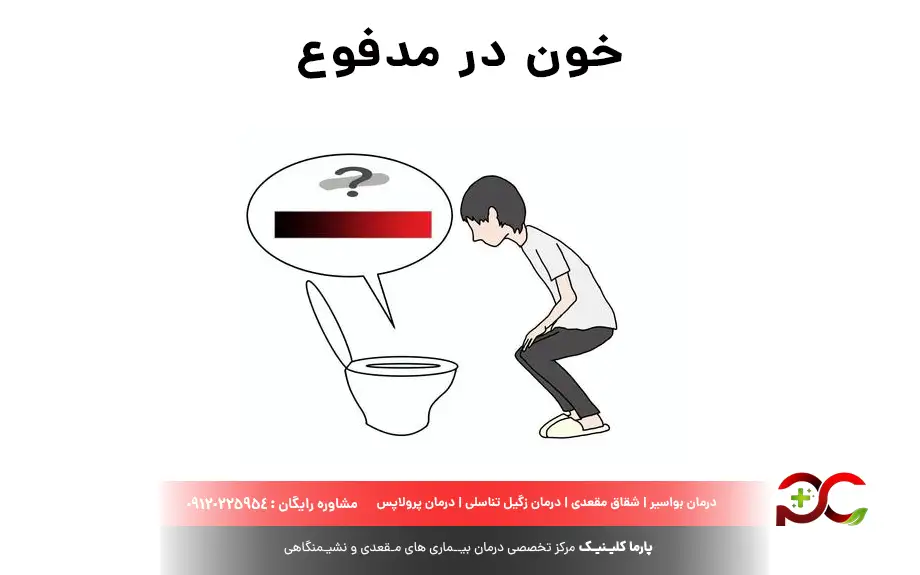 خون در مدفوع