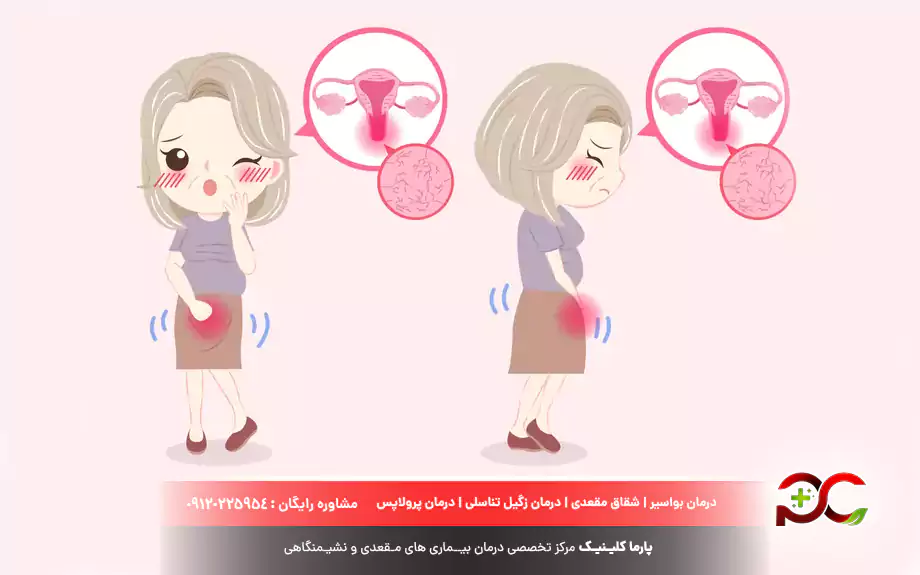 توده تناسلی در زنان