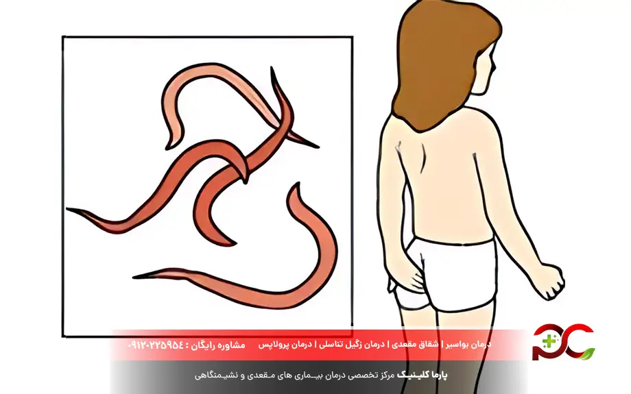 خارش مقعدی در کودکان