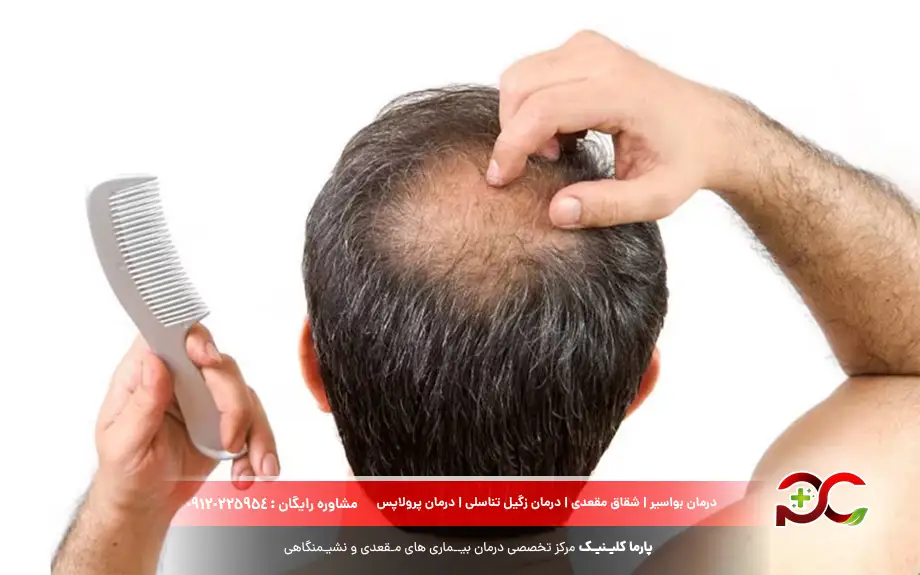 پماد بتامتازون برای ریزش سکه ای مو