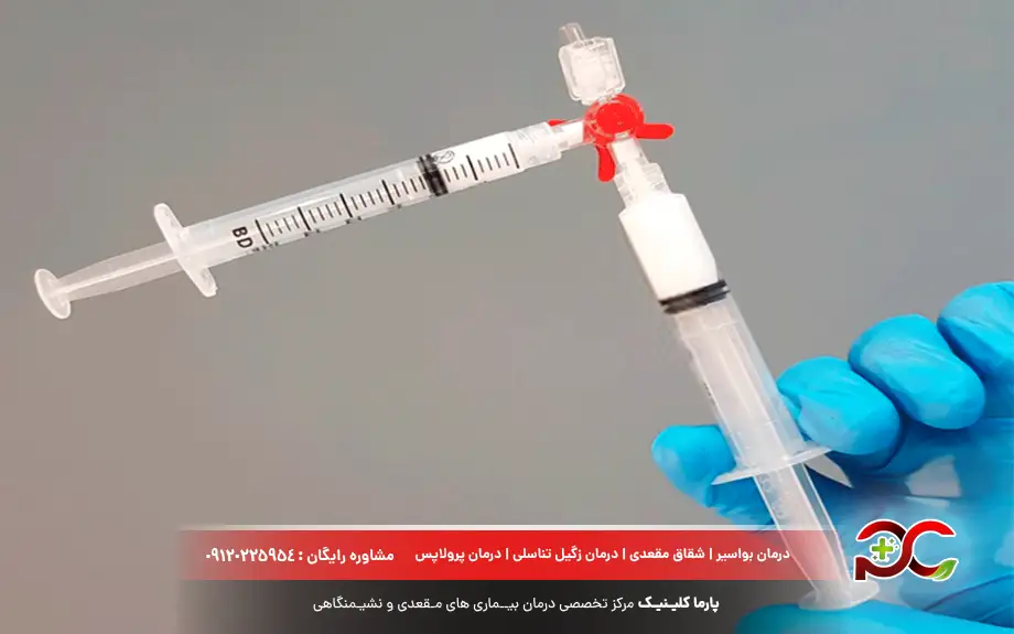 درمان کیست بارتولن