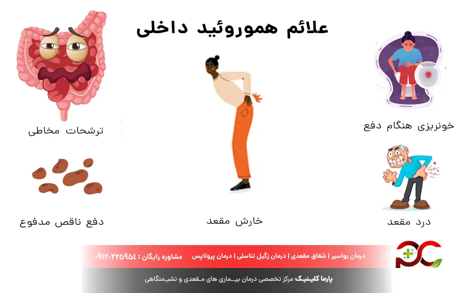 علائم هموروئید داخلی