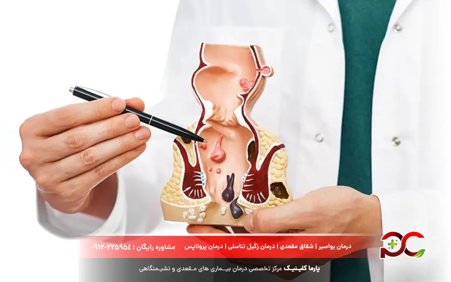 دکتر بواسیر؛ راهنمای انتخاب بهترین متخصص برای درمان بیماری‌های نشیمنگاهی