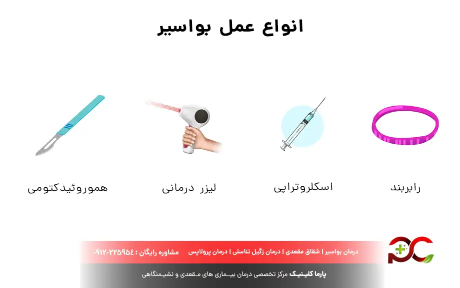 انواع عمل بواسیر