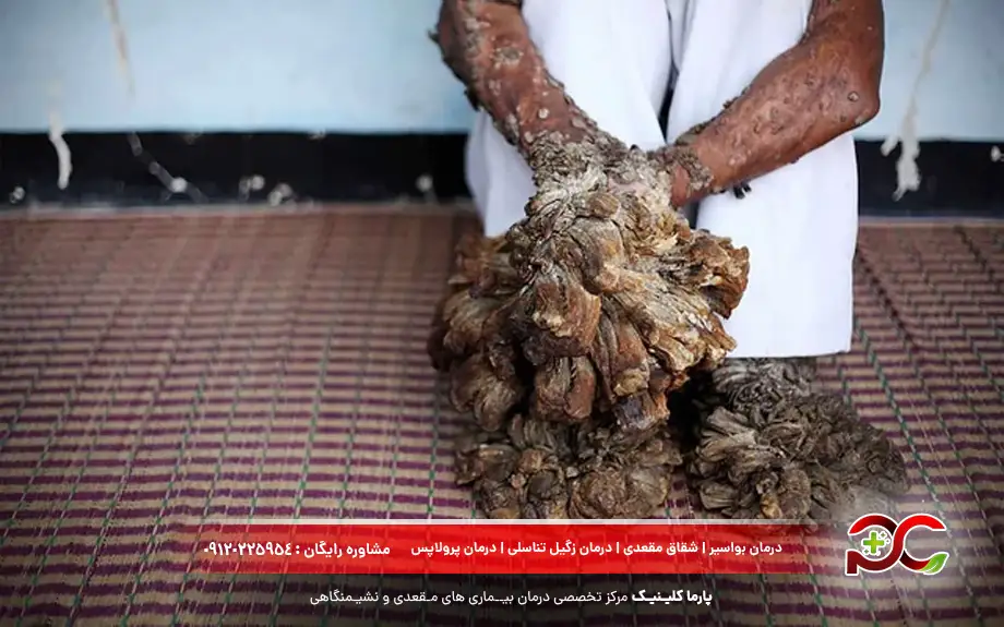 عکس بیماری درختی
