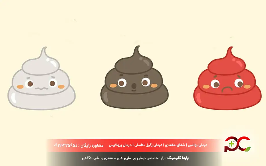 چسبندگی مدفوع