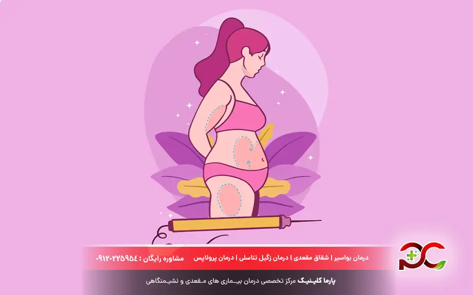 لیزر زگیل تناسلی در بارداری