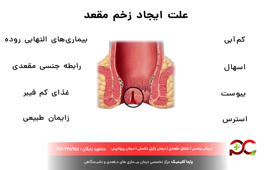 علت ایجاد زخم مقعد