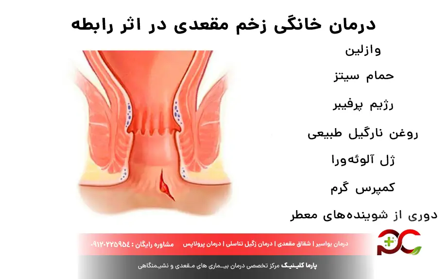 درمان خانگی زخم مقعدی در اثر رابطه