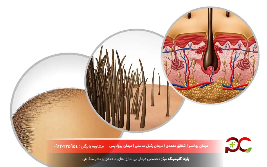 فولیکول چیست؟