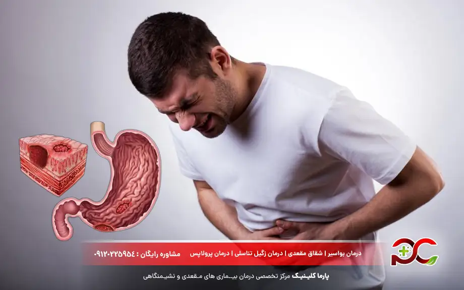 زخم‌ معده چیست؟