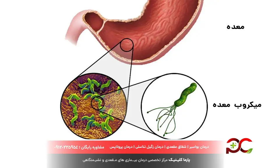 میکروب معده چیست؟