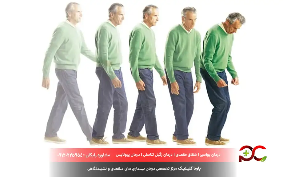 میکروب معده و ارتباط آن با بیماری‌های دیگر