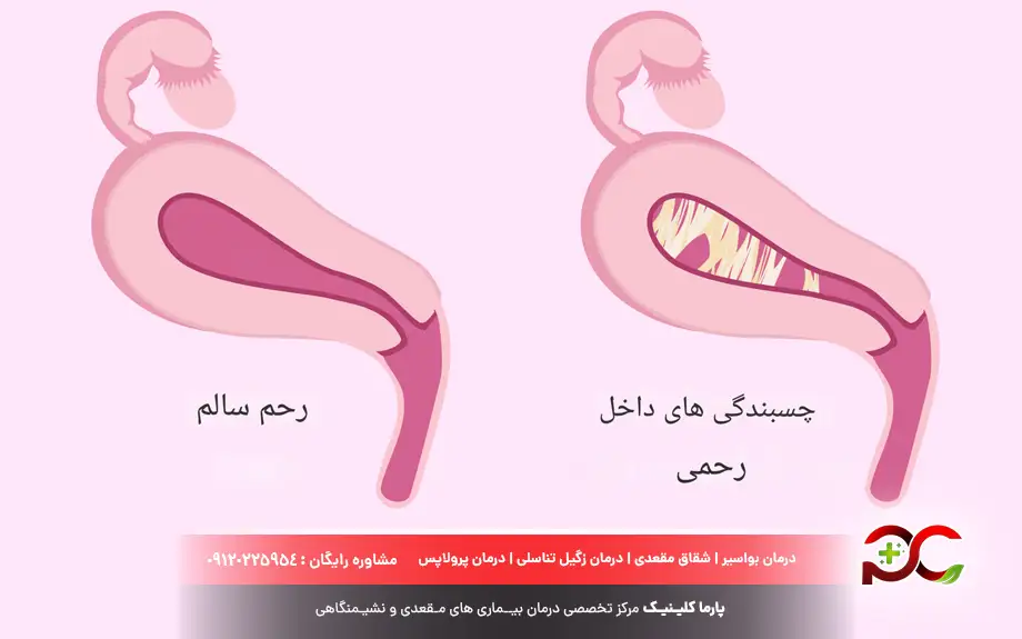 عکس رحم سالم دختر