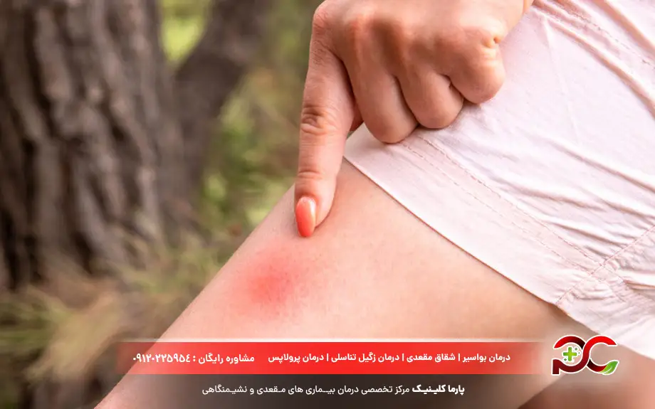 پماد موپیروسین برای چیست